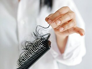 - ریزش مو را این روش‌های طبیعی متوقف کنید