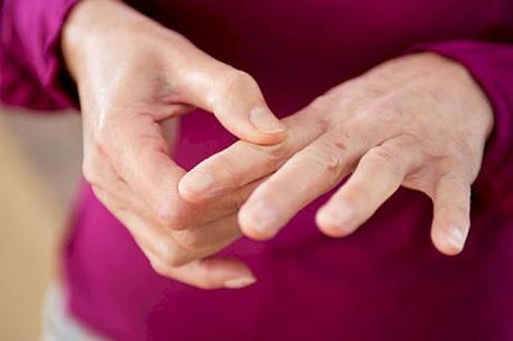 - چرا زنان بیش از مردان به آرتریت روماتوئید دچار می‌شوند؟