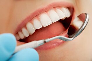 دندان .بهداشت دهان و دندان - کدام مواد غذایی به سلامتی دندان‌ها کمک می‌کنند؟