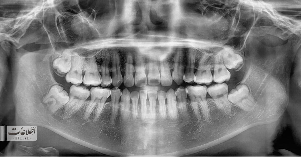 با جراحی‌های گران‌قیمت دندان خداحافظی کنید