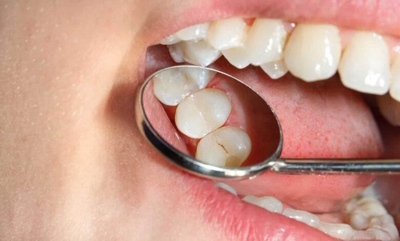 - مردم با این گرانی‌ها قید سلامت دندان را زدند