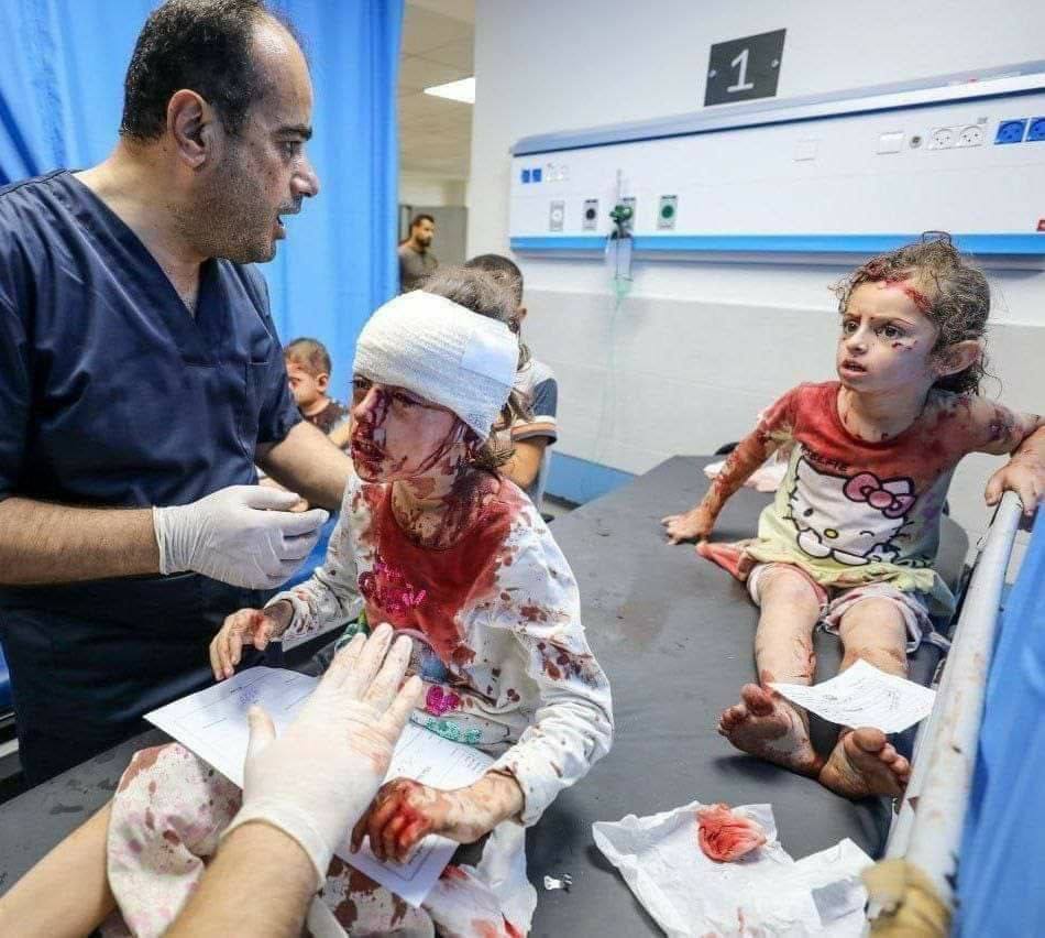 تصویر تلخ از دو کودک خونین فلسطینی در بیمارستان