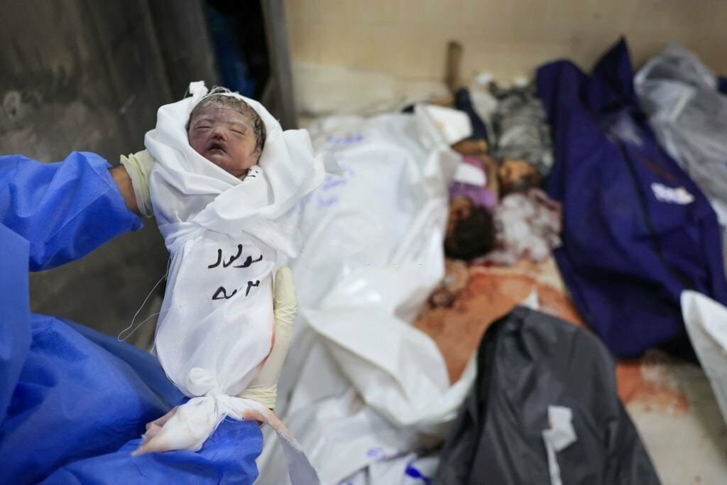 تصاویری دلخراش از جنینی که همراه مادرش هدف بمب‌های اسرائیل قرار گرفتند