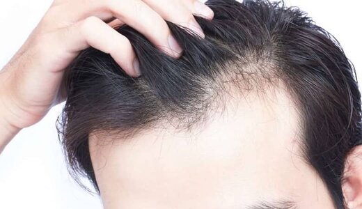 - جلوگیری از ریزش مو با این روش‌ها قطعی است