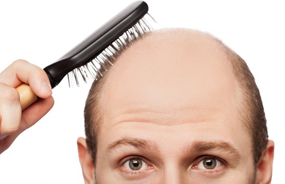 چگونه ریزش مو را متوقف کنیم؟