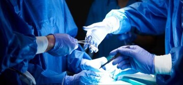 - خطر مرگ در این عمل‌های جراحی زیبایی بالا است