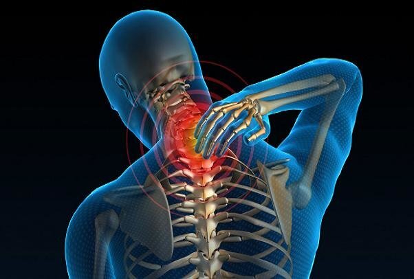 - چه مواقعی مشکل گردن به شکل سردرد بروز پیدا می‌کند؟